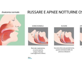 Apnea notturna: urge la formazione, malati non trattati