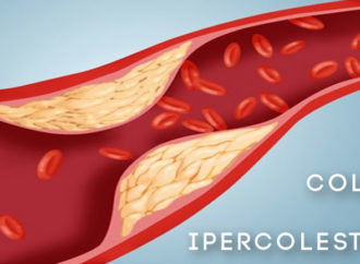 Quando controllare il livello di colesterolo nel sangue?