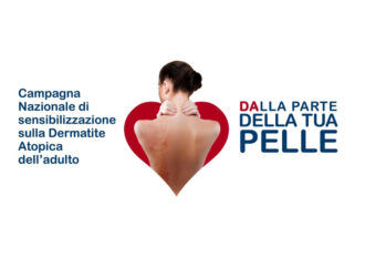 “Dalla parte della tua pelle”. Screening gratuito per chi ha la dermatite atopica