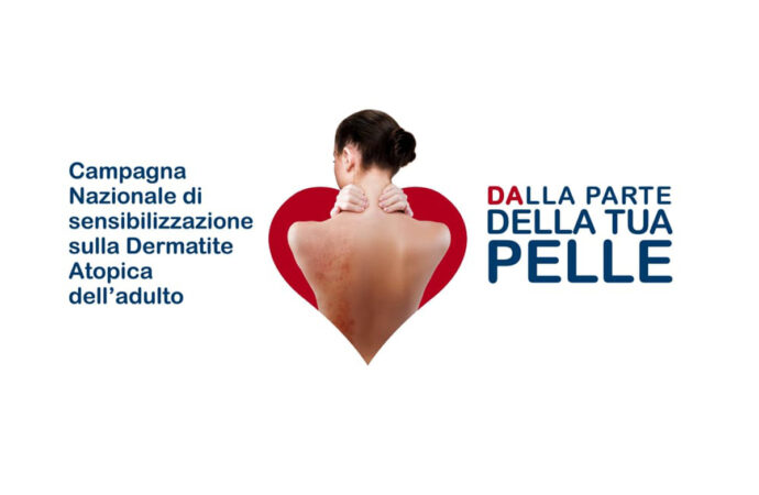 “Dalla parte della tua pelle”. Screening gratuito per chi ha la dermatite atopica