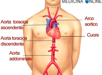 Intervento innovativo a Lecce dove si è ricostruita l’intera aorta